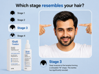 TrueGro™ 5% Minoxidil + 0.1% Finasteride