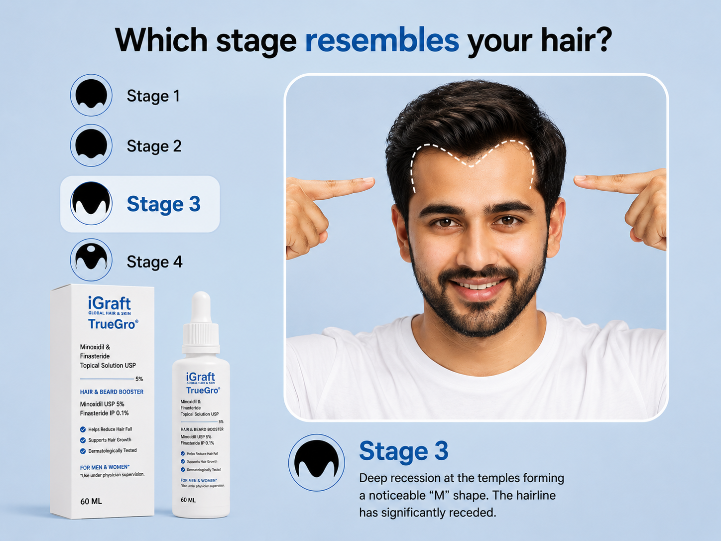 TrueGro™ 5% Minoxidil + 0.1% Finasteride