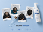 TrueGro™ 5% Minoxidil + 0.1% Finasteride