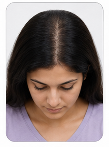 Stage 2 - Women