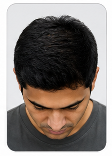 Stage 2 - Men