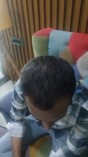 After - Month 3